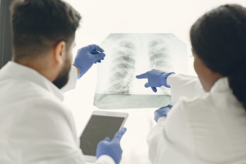 Relevancia biológica de los genes implicados en la enfermedad pulmonar obstructiva crónica (EPOC)
