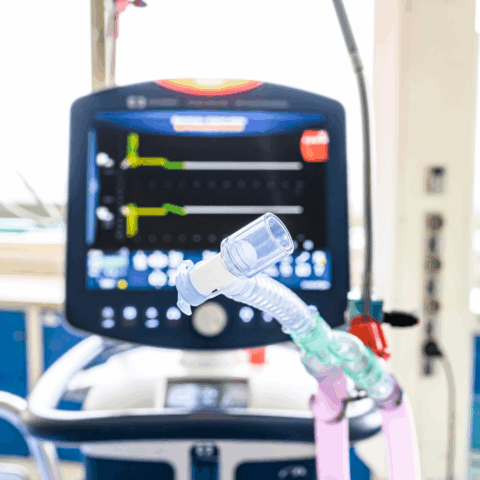 Pulmón artificial: entendiendo la ciencia detrás de la ventilación mecánica