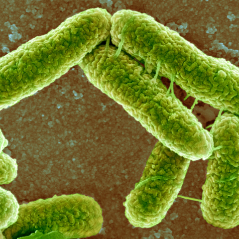 Escherichia coli: la bacteria que podría estar en tu comida