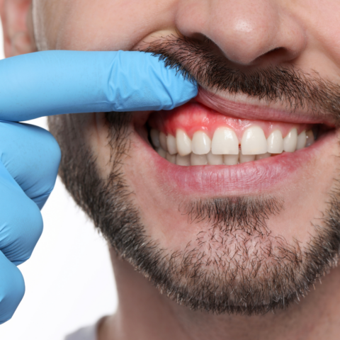 Encías y azúcar: El vínculo oculto de la microbiota oral y la diabetes