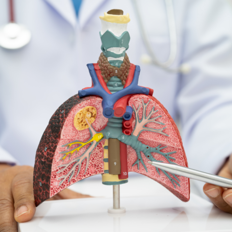 Neumonía lipoidea: El peligro oculto de los remedios caseros