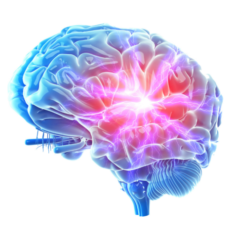Infarto Cerebral: ¿El origen de un cortocircuito permanente?