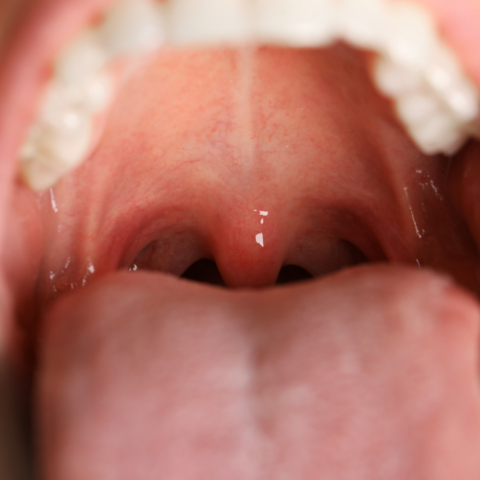 Pequeños habitantes, grandes efectos: microbiota oral y resistencia a la insulina