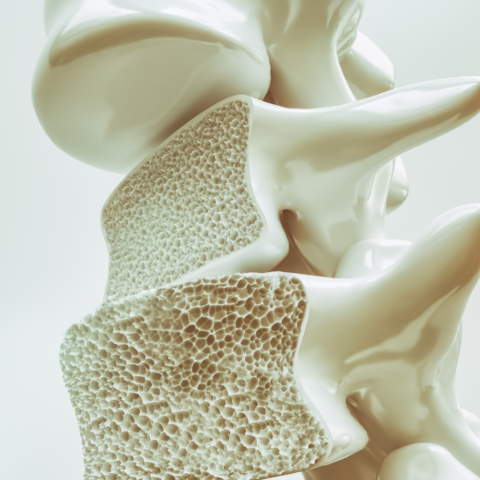 La edad real de tus huesos: los relojes biológicos pueden predecir la osteoporosis y fracturas