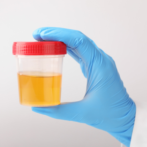 ¿De qué color es tu salud? Guía práctica para leer la orina sin alarmismos