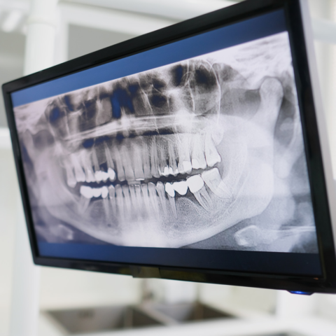 Radiografías dentales: la importancia de ver lo que el ojo no puede